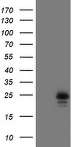 Invitrogen UBE2E3 Monoclonal Antibody (OTI7E8) 100 &mu;L; Unconjugated:Antibodies,