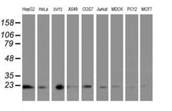 Invitrogen UBE2E3 Monoclonal Antibody (OTI7E8) 100 &mu;L; Unconjugated:Antibodies,