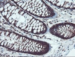 Invitrogen TRIP Monoclonal Antibody (OTI2D4) 100 &mu;L; Unconjugated:Antibodies,