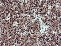 Invitrogen TRIP Monoclonal Antibody (OTI2D4) 100 &mu;L; Unconjugated:Antibodies,