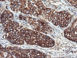 Invitrogen USP9X Monoclonal Antibody (OTI2G7) 100 &mu;L; Unconjugated:Antibodies,