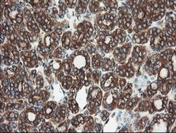 Invitrogen USP9X Monoclonal Antibody (OTI2G7) 100 &mu;L; Unconjugated:Antibodies,