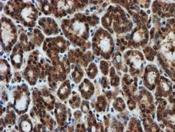 Invitrogen PSMA6 Monoclonal Antibody (OTI5H3) 100 &mu;L; Unconjugated:Antibodies,