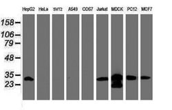 Invitrogen PSMA6 Monoclonal Antibody (OTI5H3) 100 &mu;L; Unconjugated:Antibodies,