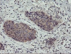 Invitrogen ZNF365 Monoclonal Antibody (OTI1B7) 100 &mu;L; Unconjugated:Antibodies,