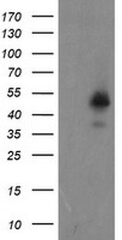 Invitrogen ZNF365 Monoclonal Antibody (OTI2D9) 100 &mu;L; Unconjugated:Antibodies,