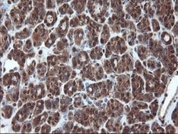 Invitrogen PSMA6 Monoclonal Antibody (OTI7C2) 100 &mu;L; Unconjugated:Antibodies,