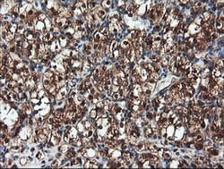 Invitrogen PSMA6 Monoclonal Antibody (OTI7C2) 100 &mu;L; Unconjugated:Antibodies,