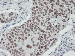 Invitrogen SENP2 Monoclonal Antibody (OTI3D3) 100 &mu;L | Buy Online | Invitrogen&trade; | Fisher Scientific