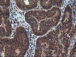 Invitrogen SENP2 Monoclonal Antibody (OTI3E7) 100 &mu;L; Unconjugated:Antibodies,
