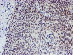 Invitrogen TPRKB Monoclonal Antibody (OTI3E3) 100 &mu;L; Unconjugated:Antibodies,