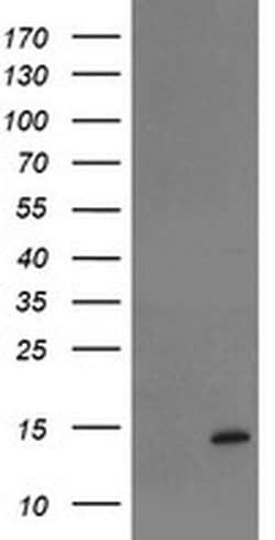 Invitrogen TPRKB Monoclonal Antibody (OTI3E3) 100 &mu;L; Unconjugated:Antibodies,