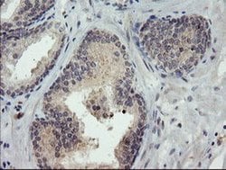 Invitrogen TIGD1 Monoclonal Antibody (OTI4G9) 100 &mu;L; Unconjugated:Antibodies,