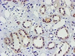 Invitrogen TIGD1 Monoclonal Antibody (OTI4G9) 100 &mu;L; Unconjugated:Antibodies,