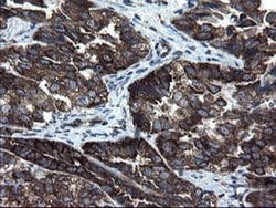 Invitrogen CNOT4 Monoclonal Antibody (OTI1H2) 100 &mu;L; Unconjugated:Antibodies,