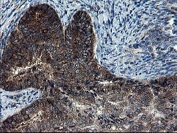 Invitrogen CNOT4 Monoclonal Antibody (OTI1H2) 100 &mu;L; Unconjugated:Antibodies,
