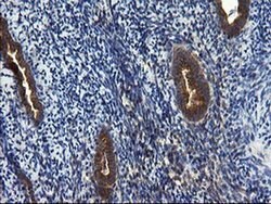 Invitrogen CNOT4 Monoclonal Antibody (OTI1H2) 100 &mu;L; Unconjugated:Antibodies,