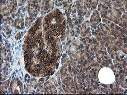 Invitrogen CNOT4 Monoclonal Antibody (OTI1H2) 100 &mu;L; Unconjugated:Antibodies,