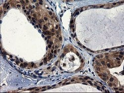 Invitrogen CNOT4 Monoclonal Antibody (OTI1H2) 100 &mu;L; Unconjugated:Antibodies,