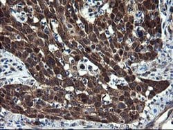 Invitrogen CNOT4 Monoclonal Antibody (OTI1H2) 100 &mu;L; Unconjugated:Antibodies,