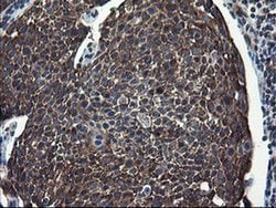 Invitrogen CNOT4 Monoclonal Antibody (OTI1H2) 100 &mu;L; Unconjugated:Antibodies,