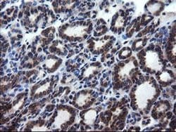 Invitrogen CNOT4 Monoclonal Antibody (OTI1H2) 100 &mu;L; Unconjugated:Antibodies,