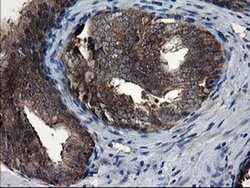 Invitrogen CNOT4 Monoclonal Antibody (OTI1H2) 100 &mu;L; Unconjugated:Antibodies,