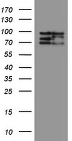 Invitrogen CNOT4 Monoclonal Antibody (OTI1H2) 100 &mu;L; Unconjugated:Antibodies,