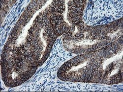 Invitrogen SnoN Monoclonal Antibody (OTI3F6) 100 &mu;L | Buy Online | Invitrogen&trade; | Fisher Scientific
