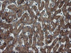 Invitrogen SnoN Monoclonal Antibody (OTI3F6) 100 &mu;L | Buy Online | Invitrogen&trade; | Fisher Scientific