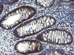 Invitrogen SnoN Monoclonal Antibody (OTI3F6) 100 &mu;L | Buy Online | Invitrogen&trade; | Fisher Scientific