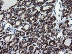 Invitrogen SnoN Monoclonal Antibody (OTI3F6) 100 &mu;L | Buy Online | Invitrogen&trade; | Fisher Scientific