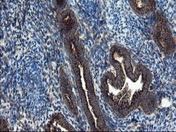 Invitrogen SnoN Monoclonal Antibody (OTI3F6) 100 &mu;L | Buy Online | Invitrogen&trade; | Fisher Scientific