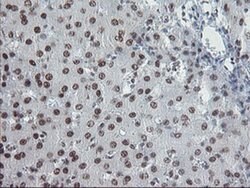 TPRKB Monoclonal Antibody (OTI3H3):Antibodies, Monoclonal