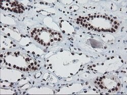 TPRKB Monoclonal Antibody (OTI3H3):Antibodies, Monoclonal