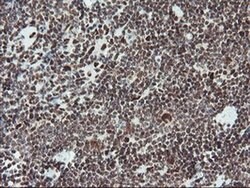 TPRKB Monoclonal Antibody (OTI3H3):Antibodies, Monoclonal