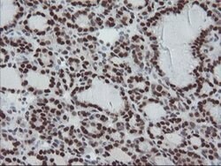 TPRKB Monoclonal Antibody (OTI3H3):Antibodies, Monoclonal