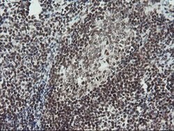 TPRKB Monoclonal Antibody (OTI3H3):Antibodies, Monoclonal