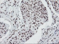 TPRKB Monoclonal Antibody (OTI3H3):Antibodies, Monoclonal