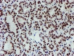 Invitrogen SLUG Monoclonal Antibody (OTI1A6) 100 &mu;L; Unconjugated:Antibodies,