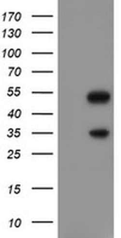 Invitrogen SLUG Monoclonal Antibody (OTI1A6) 100 &mu;L; Unconjugated:Antibodies,
