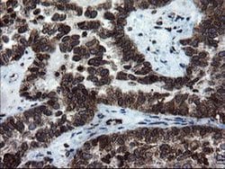 Invitrogen SnoN Monoclonal Antibody (OTI2F6) 100 &mu;L; Unconjugated:Antibodies,