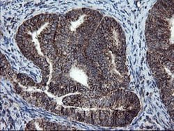 Invitrogen SnoN Monoclonal Antibody (OTI2F6) 100 &mu;L; Unconjugated:Antibodies,