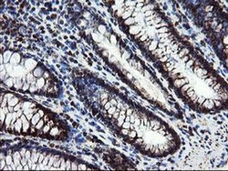 Invitrogen SnoN Monoclonal Antibody (OTI2F6) 100 &mu;L; Unconjugated:Antibodies,