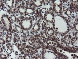 Invitrogen SnoN Monoclonal Antibody (OTI2F6) 100 &mu;L; Unconjugated:Antibodies,