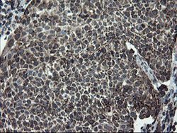 Invitrogen SnoN Monoclonal Antibody (OTI2F6) 100 &mu;L; Unconjugated:Antibodies,