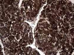 Invitrogen SnoN Monoclonal Antibody (OTI2C9) 100 &mu;L; Unconjugated:Antibodies,