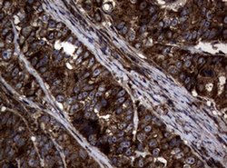Invitrogen SnoN Monoclonal Antibody (OTI2C9) 100 &mu;L; Unconjugated:Antibodies,