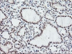 Invitrogen NYREN18 Monoclonal Antibody (OTI4H2) 100 &mu;L; Unconjugated:Antibodies,