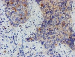 Invitrogen MYNN Monoclonal Antibody (OTI1F10) 100 &mu;L; Unconjugated:Antibodies,
